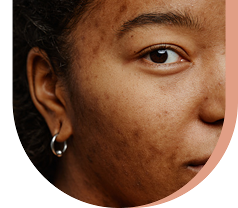 Ma peau en santé Ma peau en santé