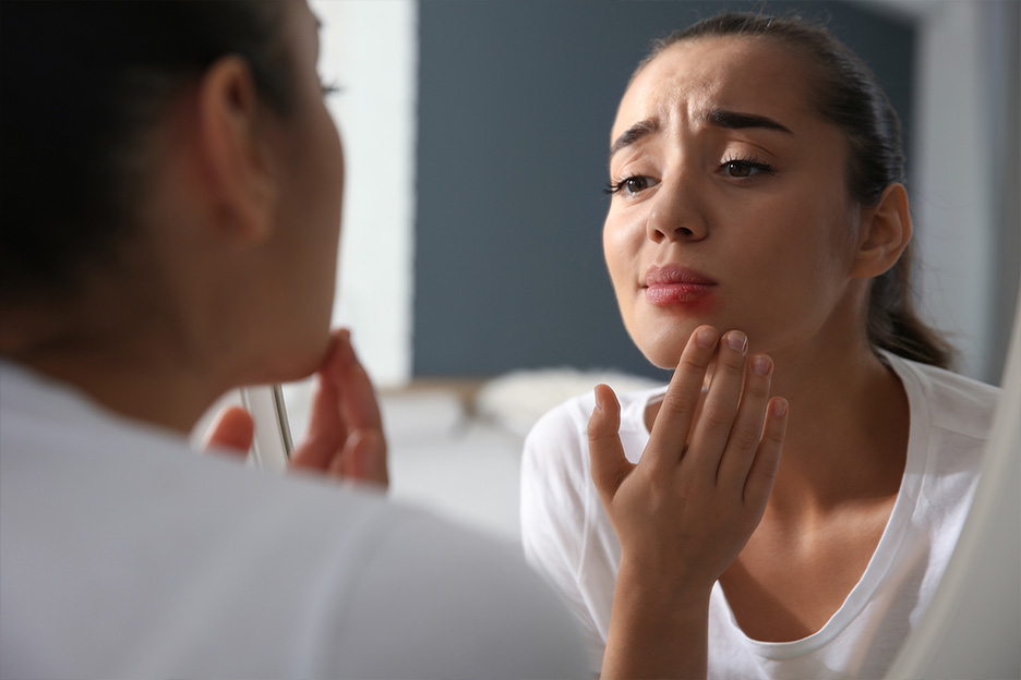 A young woman looks at herself in the mirror and examines the cold sore on her lip.